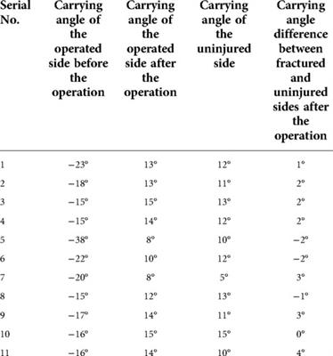 Small incision reduction and external fixation for the treatment of delayed over fourteen days supracondylar humeral fractures in children